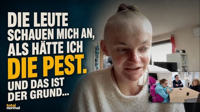 Folgencover: „Mitleid ist das Letzte, was ich möchte!“ — Clara über das Leben mit der Schmetterlingskrankheit